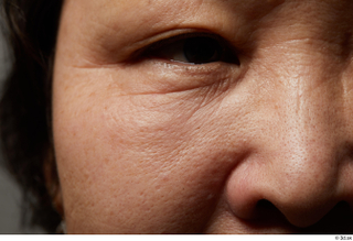 HD Face Skin Visa Kasumi cheek face nose skin pores…